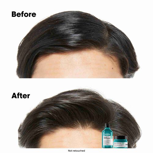 안티-오일리니스 샴푸 - 로레알 프로페셔널 | L'Oréal 파트너샵